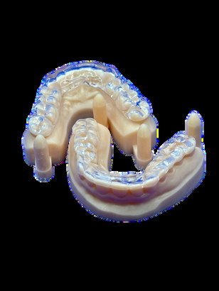 F&eacute;rula Transparente