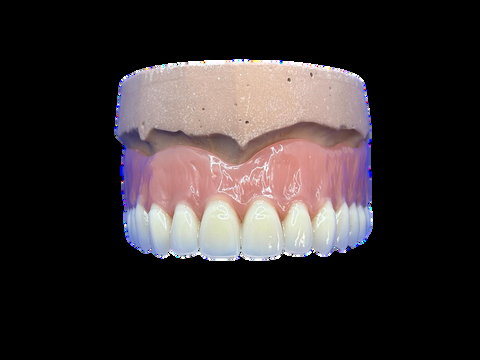 Pr&oacute;tesis Superior